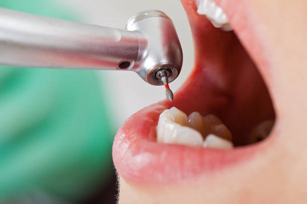 Best Emergency Dental Care for Trauma or Injury in Upper Pohatcong, NJ